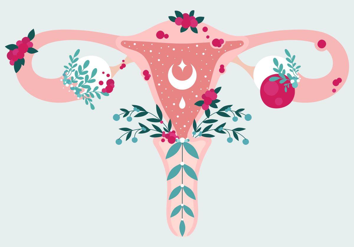 Illustration utérus atteint d'endométriose